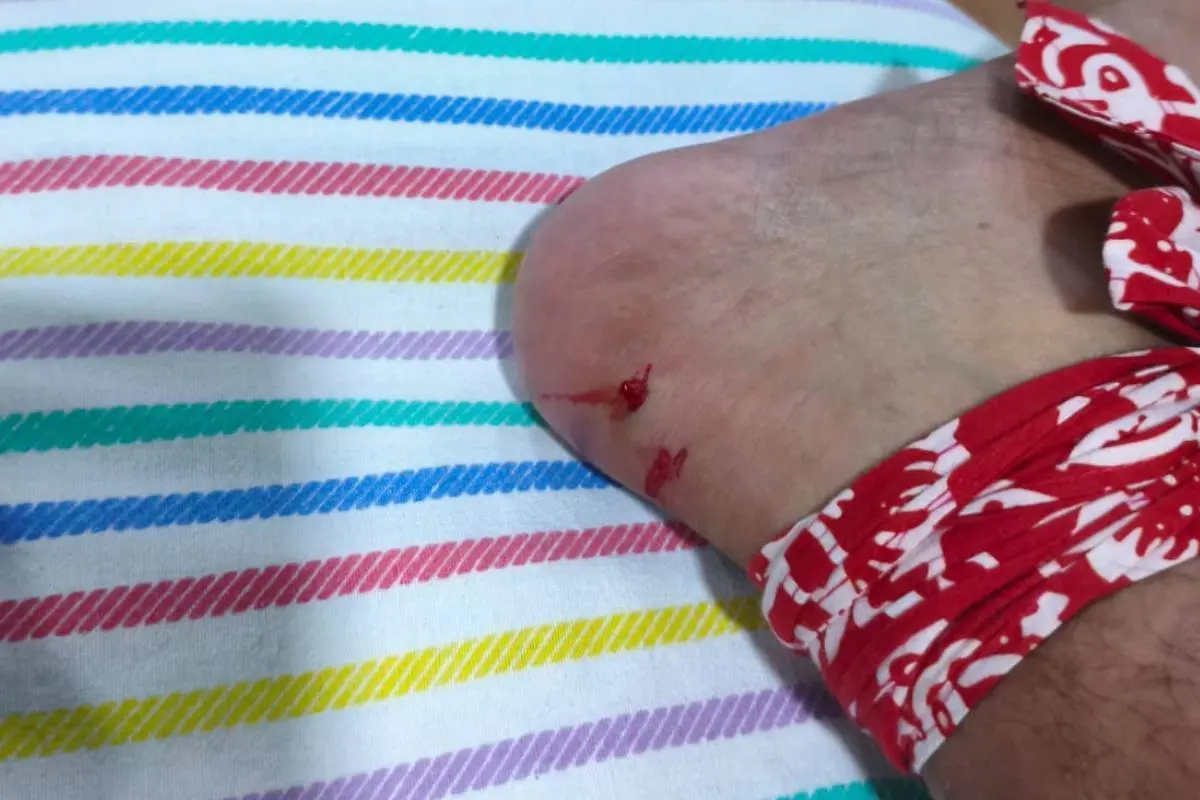 Kaki korban warga Banyuwangi
